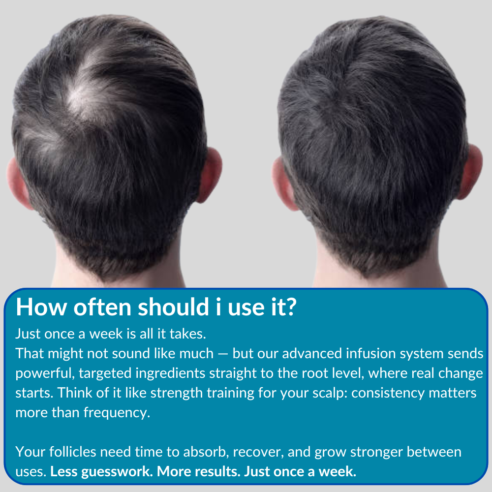 ONEFIX™ - Advanced Micro-Infusion Hair Regrowth Kit