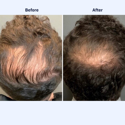 ONEFIX™ Growth Protocol 100% Natural Hair Oil