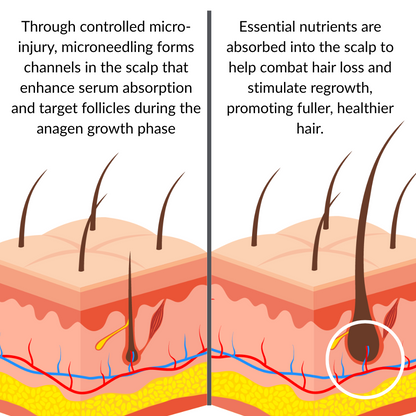 ONEFIX™ - Advanced Micro-Infusion Hair Regrowth Kit